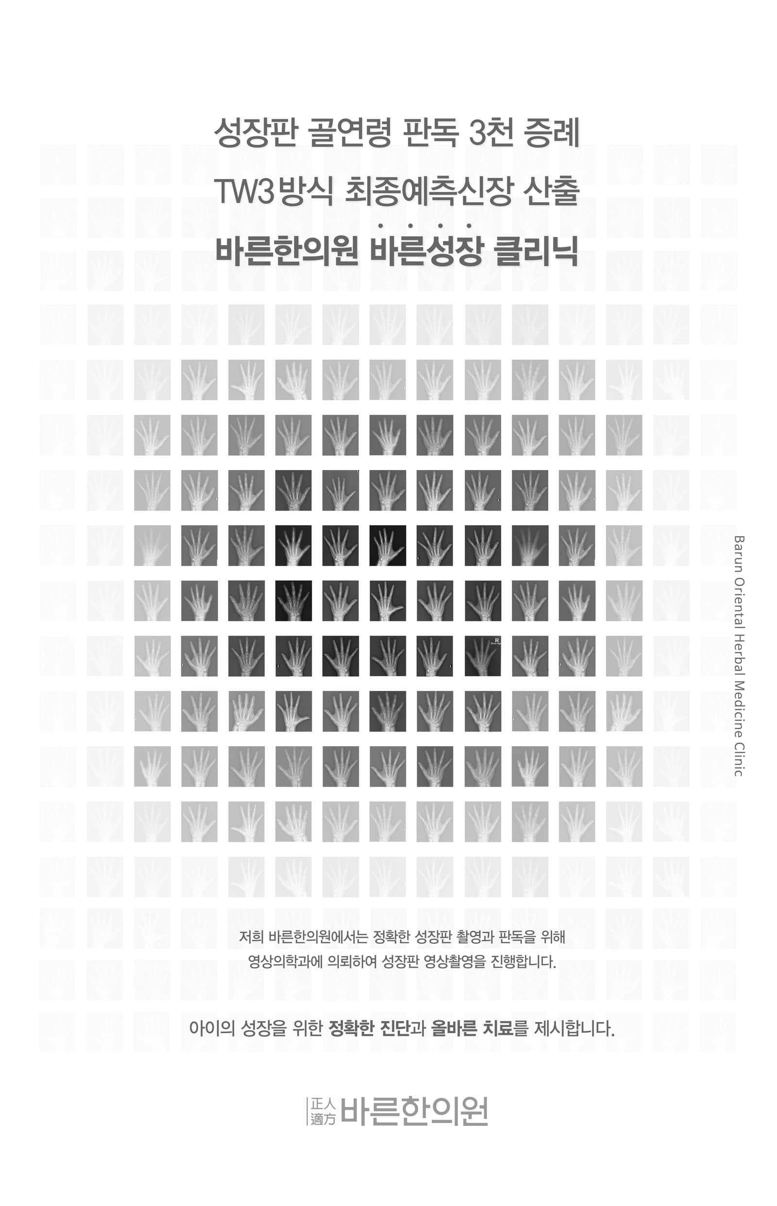바른한의원 성장판 골연령 판독 3천 증례 — TW3 방식 최종예측신장 산출