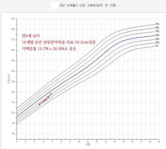 만6세 남아 저성장 성장치료